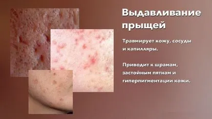 Miért nem nyomja pattanások következményei szorította az arc és a test bőrét