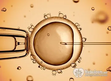 Abortusz utáni gyógyulási idő, az ajánlás