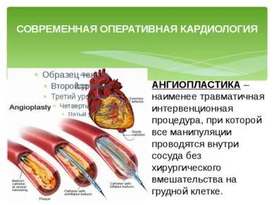 Előadás - kardiovaszkuláris betegség - ingyen letölthető