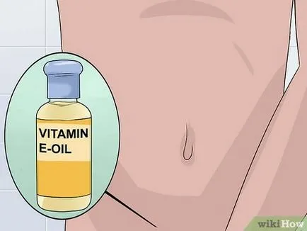 Cum de a trata escoriatii ale pielii remedii naturale
