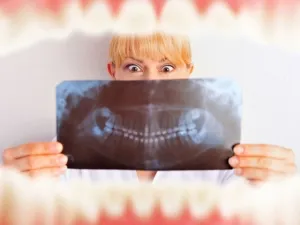Cum de a consolida gingiile, în cazul în care șovăie dinți acasă ce să facă (acasă) Cum de a consolida gingiile, în cazul în care șovăie dinți la domiciliu ce să facă