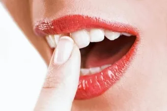 Cum de a consolida gingiile, în cazul în care șovăie dinți la domiciliu ce să facă (gingii) Cum de a consolida gingiile, în cazul în care șovăie dinți la domiciliu ce să facă