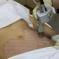 Piept de pui pentru mamele care alăptează - dacă (feluri de mâncare reteta, cum să gătească) (care alăptează) Piept de pui pentru mamele care alăptează - dacă (feluri de mâncare reteta, cum să gătească)