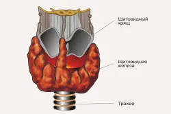 Tratamentul bolii tiroidiene autoimune cauze simptome