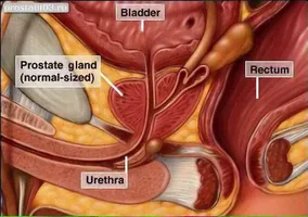 Tratamentul rețete personalizate de prostatita cu albine Podmore (tratament) Tratamentul rețete personalizate de prostatita cu albine Podmore