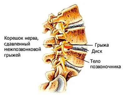 Indicații pentru IRM a coloanei vertebrale, contraindicații