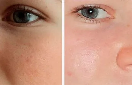 Persoana de curățare Vid comentarii care este, înainte și după fotografii (vid) Persoana de curățare Vid comentarii care este, înainte și după fotografii