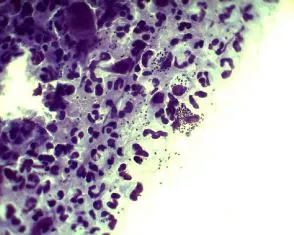 Bacteriile si microbii la microscop (fotografii)