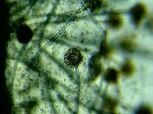 Bacteriile si microbii la microscop (fotografii)