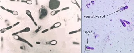 cpory Bacteriile și sporulare
