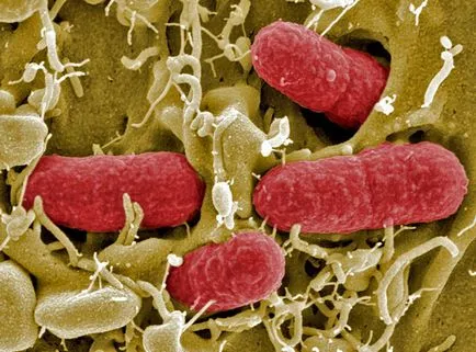 Bacteriile si microbii la microscop