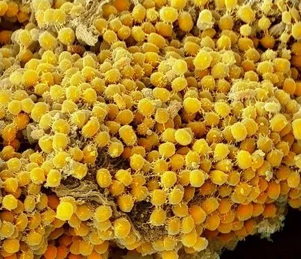 Bacteriile si microbii la microscop