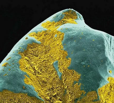 Bacteriile si microbii la microscop