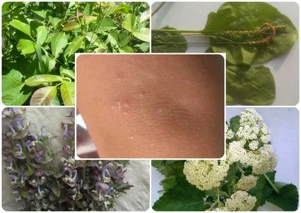 corp Râios, și de a afla cauza blistere si-tratament, excrescente pe piele (vezicule) corp Râios, și de a afla cauza de vezicule și de tratament, excrescente pe piele
