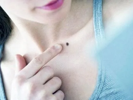 Ce se întâmplă dacă ai distruge sau deteriora birthmark ei