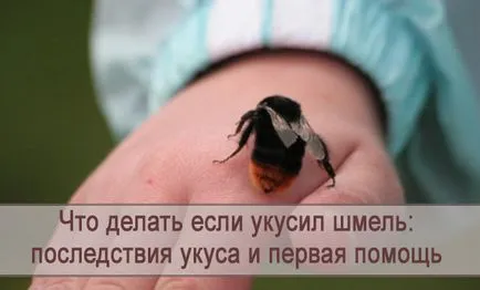 Ce să fac dacă muscat de un efect intepaturi de albina și prim ajutor