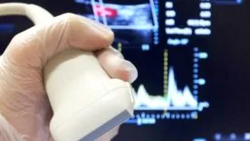 Ce este Ecografia Doppler vasculară a gâtului și capului, așa cum fac și care arată creier ultrasunete, preț și