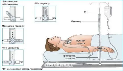 CVP Rata (presiunea venoasă centrală), patologii posibile de măsurare