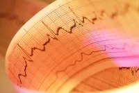 Clare și detaliate cu privire la formele atipice de infarct miocardic