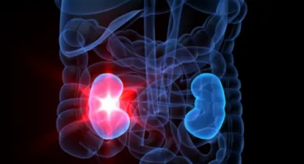 Modificări în parenchimul renale difuze, medicina populara (medicament) Modificări în parenchimul renale difuze, medicina populară