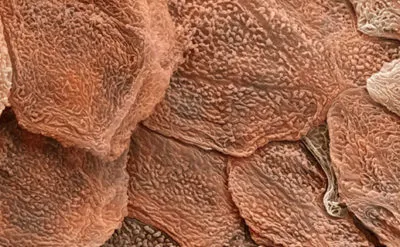 Epiderma este ceea ce este, straturi de celule