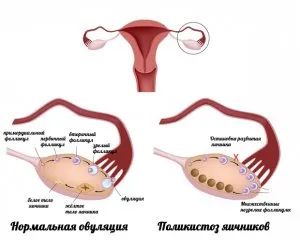 Foliculilor în ovare că este