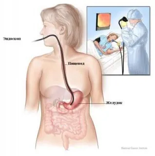stomac gastroscopy sub anestezie generală (EGD)