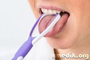 Cum se curata limba
