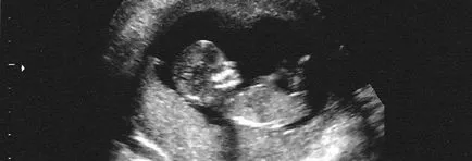 Cum și când se poate determina sexul unui copil nenăscut prin ultrasunete (așa cum este determinat de sexul copilului prin utilizarea ultrasunetelor) Cum și când se poate determina sexul unui copil nenăscut cu ultrasunete