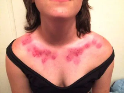 Cum de a pune Hickey