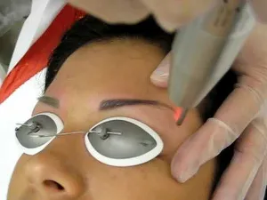 Ca sprâncene tatuaj deducem la domiciliu, dacă laserul poate elimina
