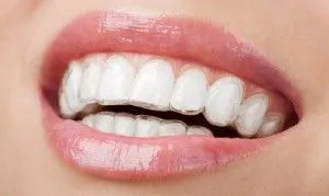 Capa pentru dinții dentare, copii