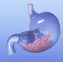 digestie intestinale