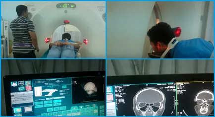 Tomografia computerizata (CT) scanare a nasului și a sinusurilor paranazale pret, foto, video