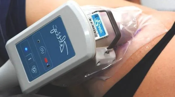 Cryolipolysis ea, indicații, contraindicații