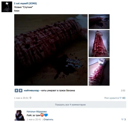 Cine și ce a făcut - un grup de moarte - în VKontakte, Apparat (deces) Cine și ce a făcut - un grup de moarte - în VKontakte, Apparat