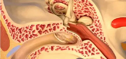 Urechile de tratament cerumen si ciuperci la om (umane) urechi și ciuperca la om Tratament de cerumen