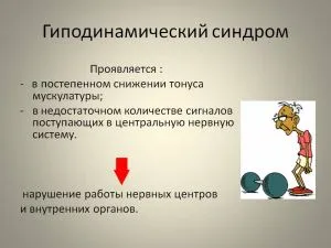 disfuncții cerebrale minime la copii cauze, simptome, sindromul de tratament ppm