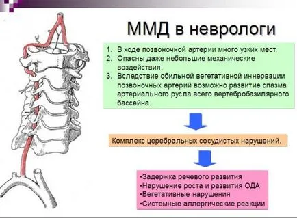 disfuncții cerebrale minime la copii cauze, simptome, sindromul de tratament ppm