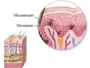 Poate birthmarks se estompeze și de ce dispar (mol) Poate birthmarks se estompeze și de ce dispar