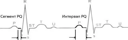 ECG normal - studopediya
