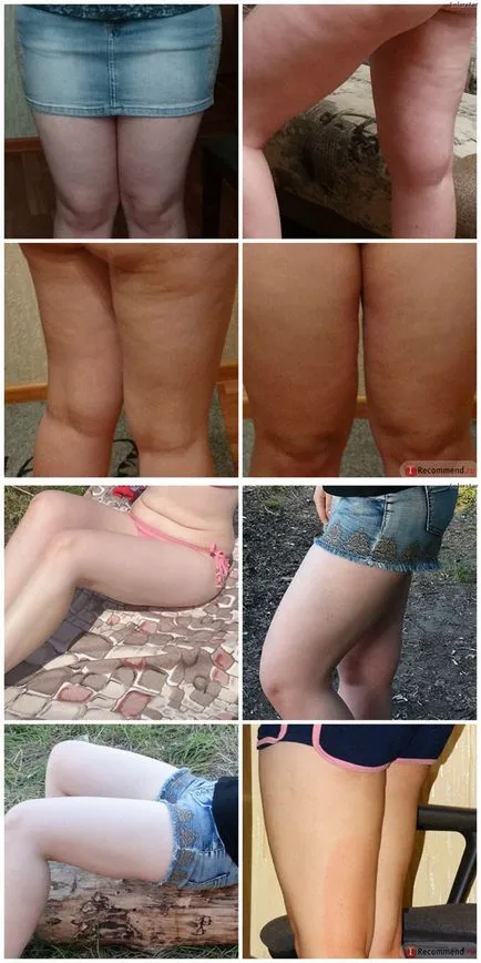 Ambalarea celulitei - dovedite rețete, reguli de