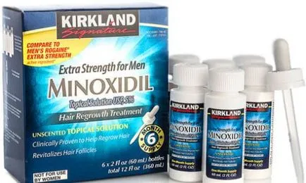 Tratamentul Alopecia areata de masculi de reproducție chelie (alopecie) Alopecia areata Tratamentul de masculi de reproducere chelie