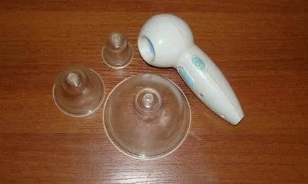 Tratamentul Alopecia areata de masculi de reproducție chelie (tratament) Alopecia areata Tratamentul de masculi de reproducere chelie
