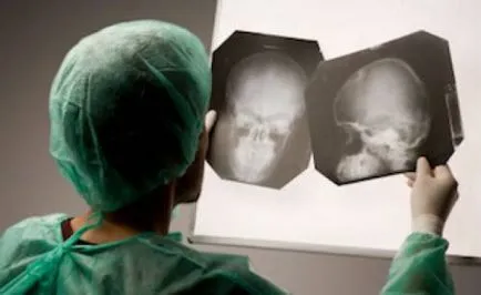 Schimbări focale de origine vasculară a creierului care este (Geneza) Schimbări focale de origine vasculară a creierului care este