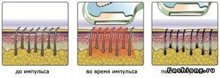 Experimentați o îndepărtare a părului acasă - o încercare de a număra trei