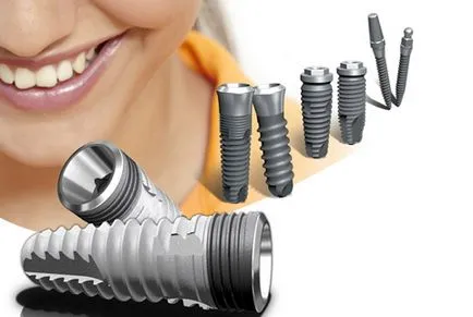 Dinte implant simptome de respingere și cauzele