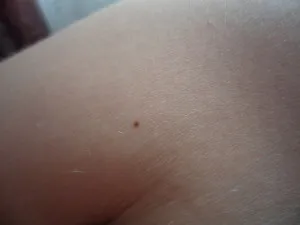 De ce ar trebui să se estompeze nevilor fie frică de acest lucru