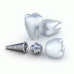 Semne si simptome de respingere dintre motivele principale implant dentar