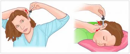 Ear lavaj tratament perhidrol otitei, îndepărtarea cerumen (ureche peroxid de hidrogen de curățare) Ear lavaj tratament perhidrol otitei, îndepărtarea cerumenului